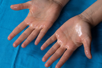 Palmar _ Plantar 330×220